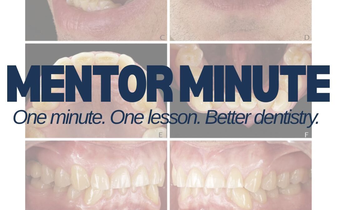 Mentor Minute: Teeth don’t fail alone